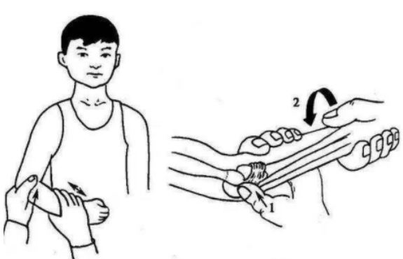 手臂脱臼复位法图解怎么做小编教你简单复位法