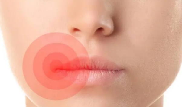 嘴唇肿痛是因为什么呢唇肿五大常见病因和临床表现揭秘