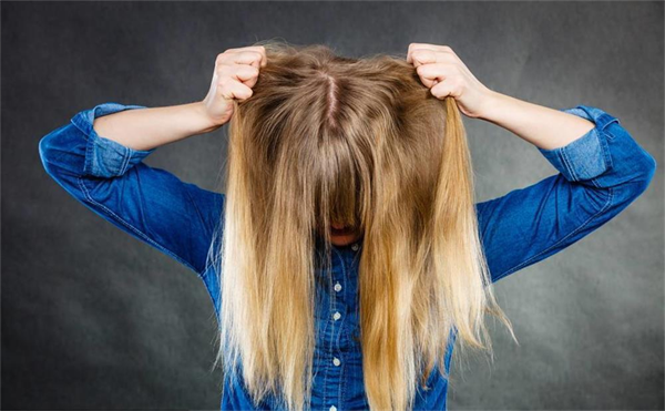 难道头发黄是肾虚吗 这三种身体问题可能导致头发变黄