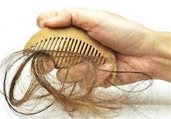 接头发会导致脱发吗 接头发会很容易掉头发吗