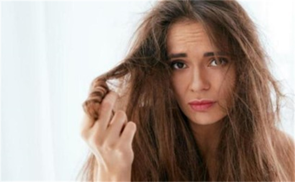 烫头发有点痒正常吗 烫头发后怎么护理头发