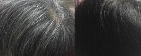 白头发染了会越来越多吗 白头发染黑能维持多久