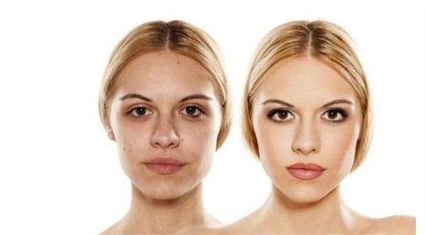 皮肤暗黄会造成什么影响 皮肤暗黄会自然恢复吗