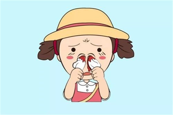 流鼻血会得什么病 流鼻血会遗传吗