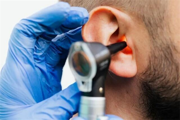中耳炎流脓怎么办 中耳炎流脓发臭严重吗