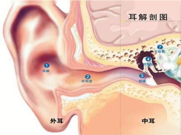 中耳炎怎么治疗 中耳炎能根治吗